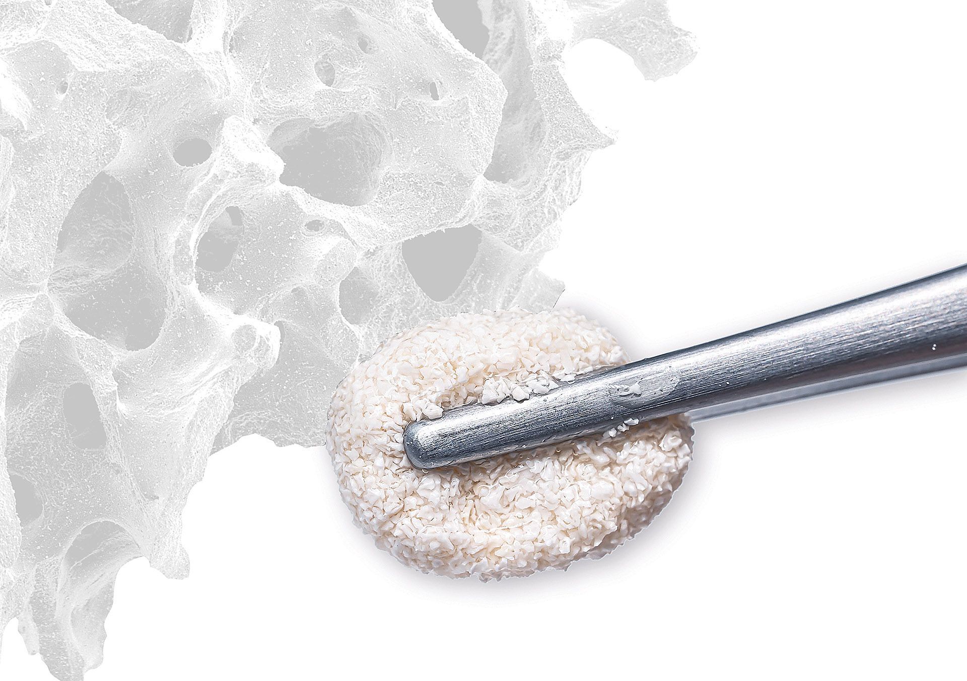 cerabone® plus botiss, 0,5 ml, Partikelgröße 0,5-1,0 mm, B1810