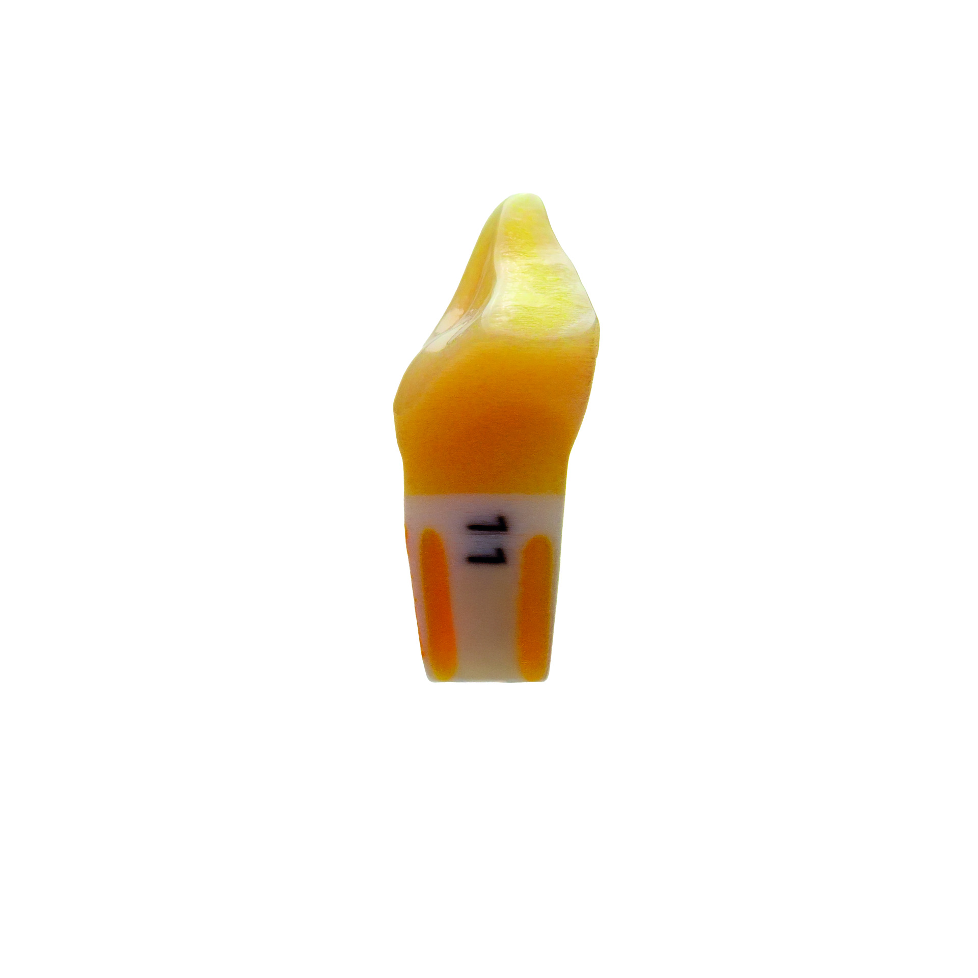 myteeth Übungszahn 11, mit Frontzahn Fraktur - 2