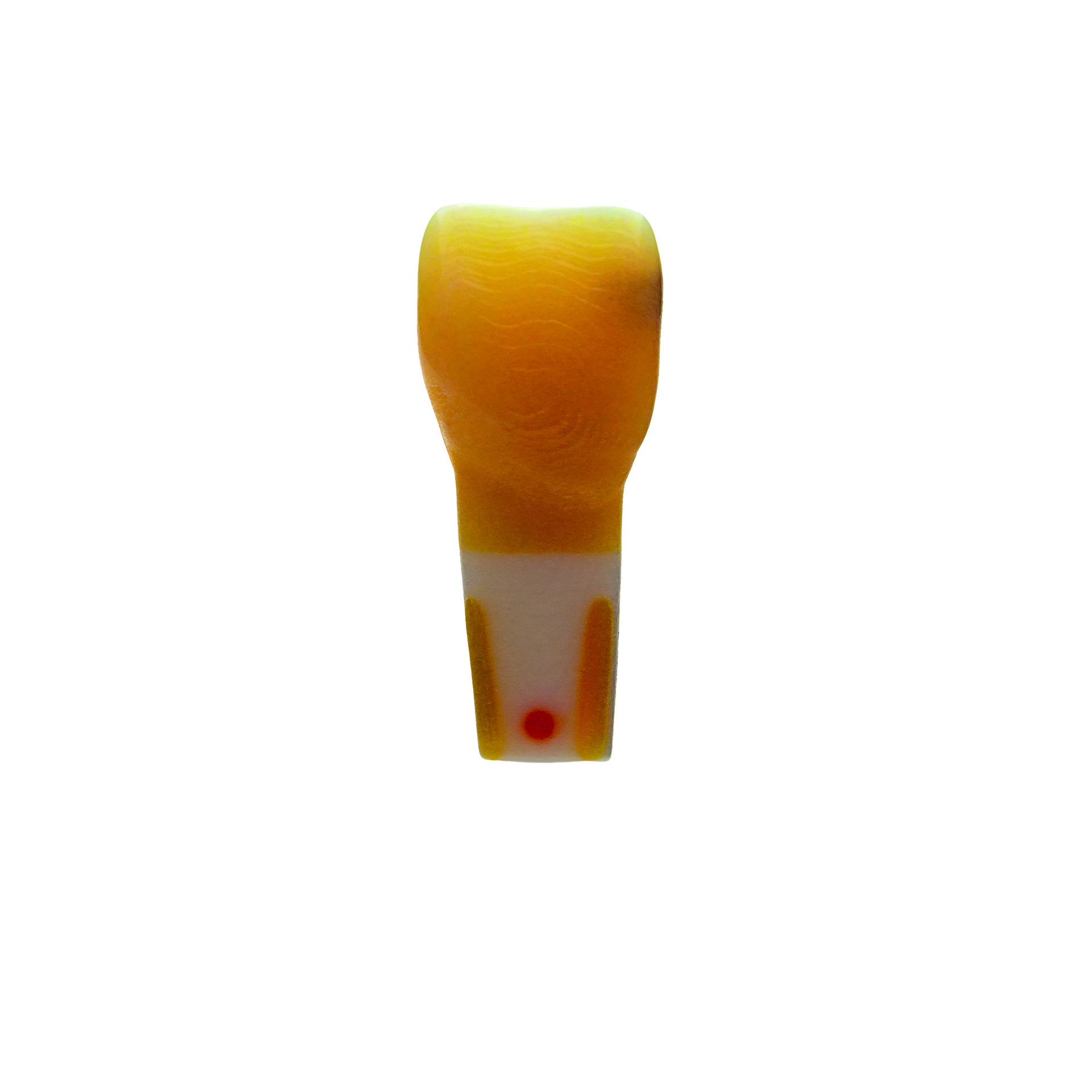 myteeth Übungszahn 11, vollanatomisch mit Kariesdefekt