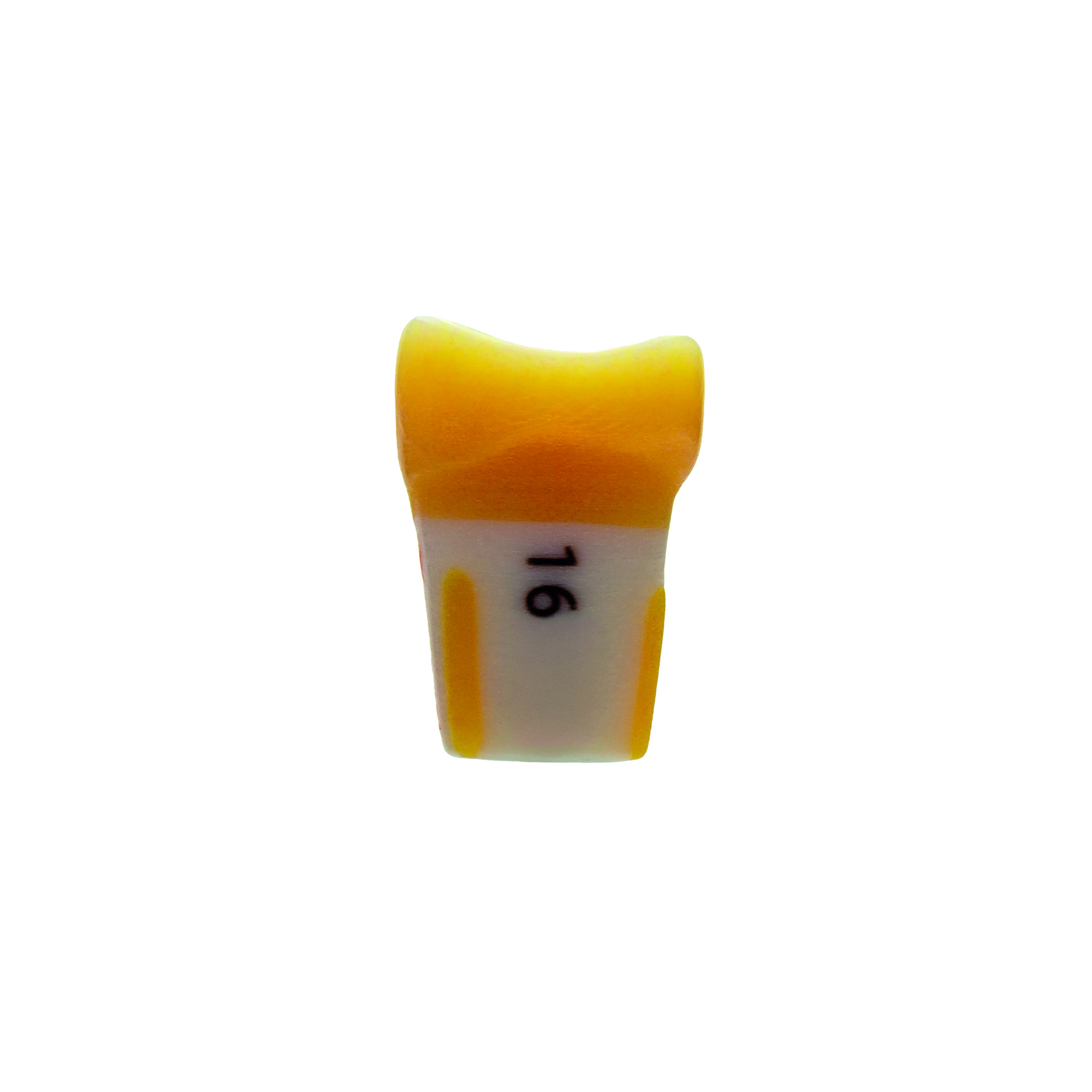 myteeth Übungszahn 16, mit okklusaler Veneer / Table- Top Präparation - 2