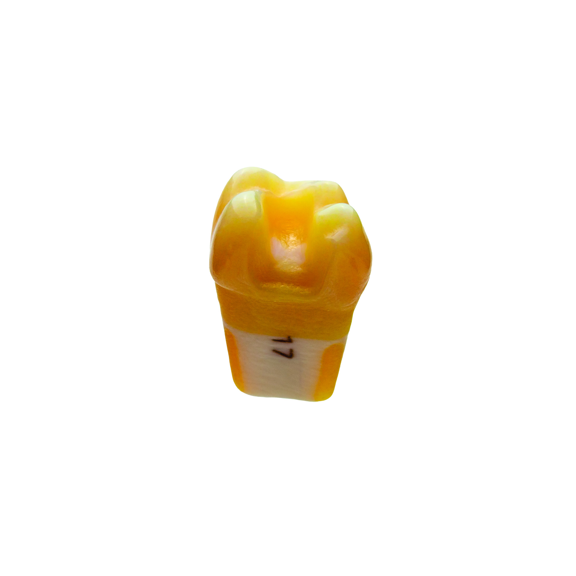 myteeth Übungszahn 17, mit MO Inlay Präparation - 4