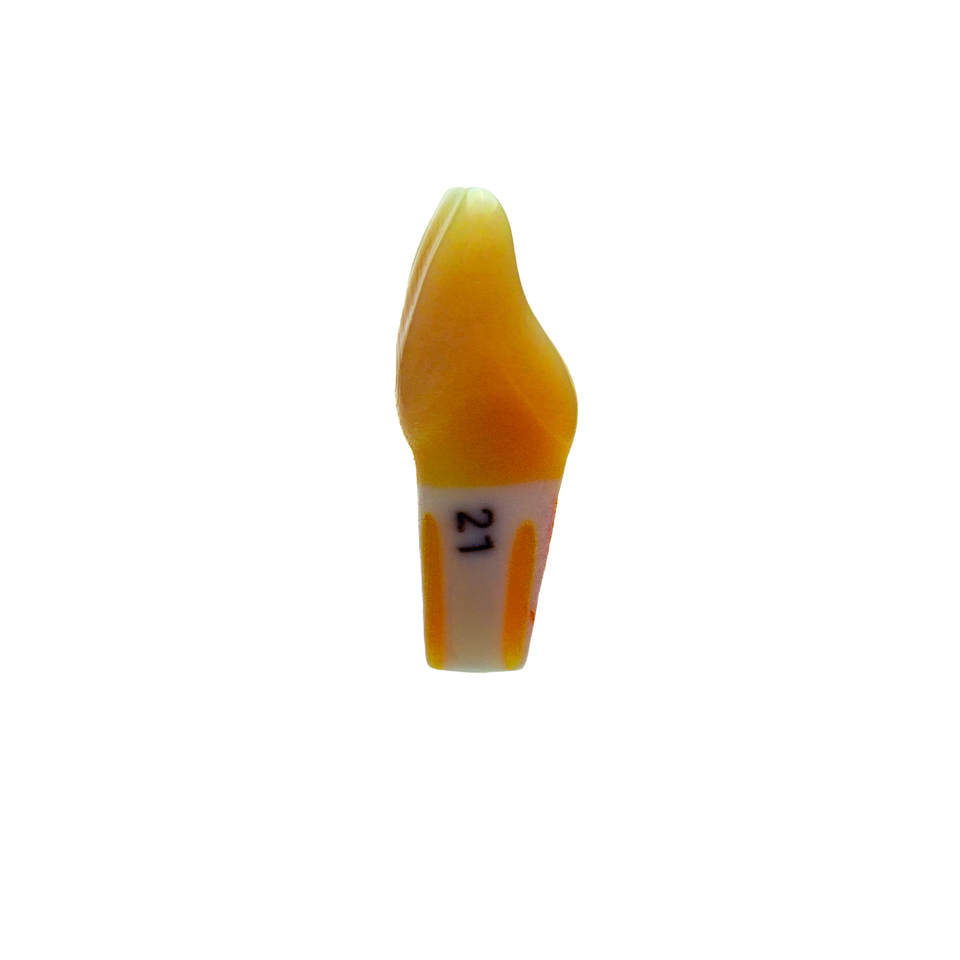 myteeth Übungszahn 21, mit vollanatomischem Kariesdefekt - 4