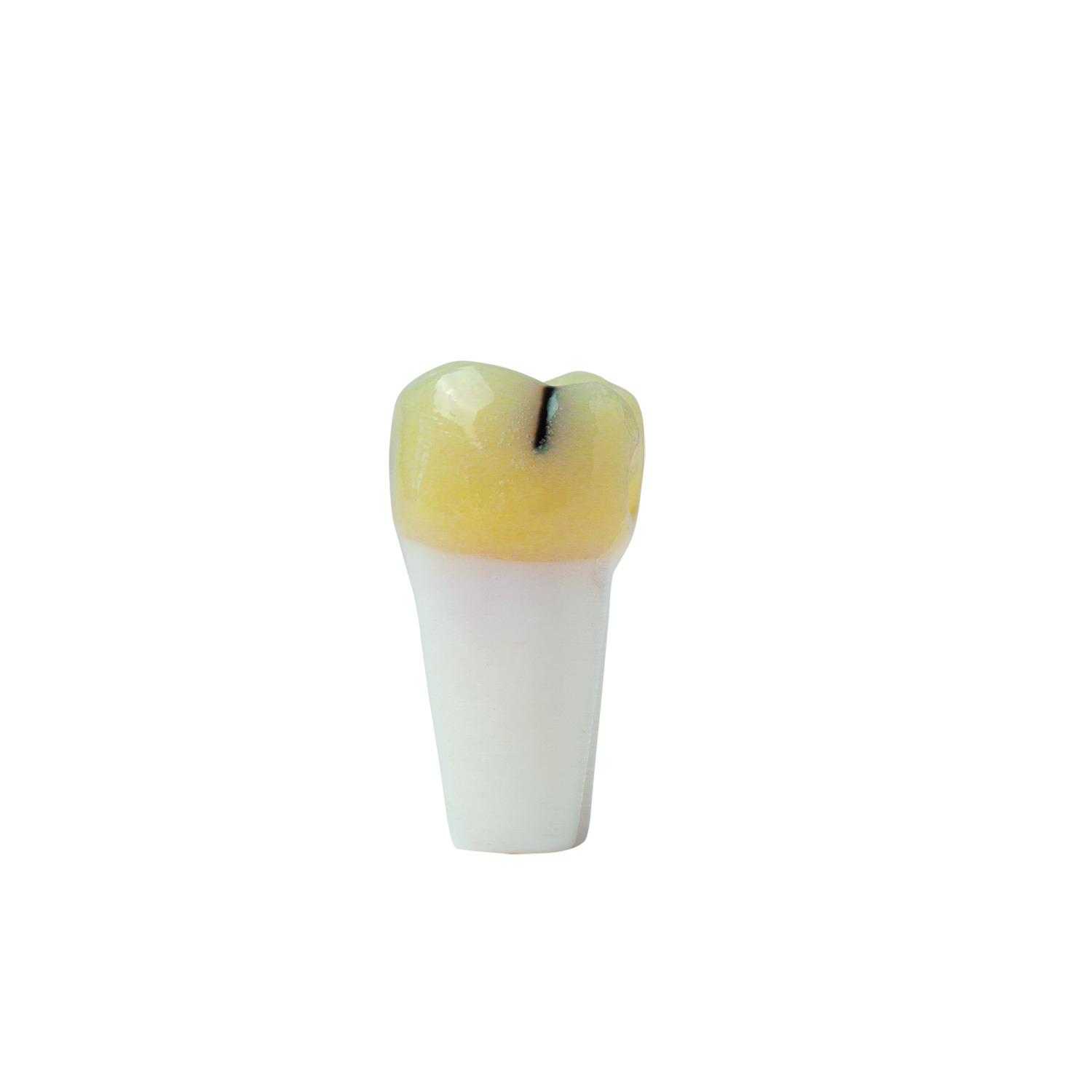 myteeth Übungszahn 26, mit MD Inlay Präparation und Kariesdefekt - 2