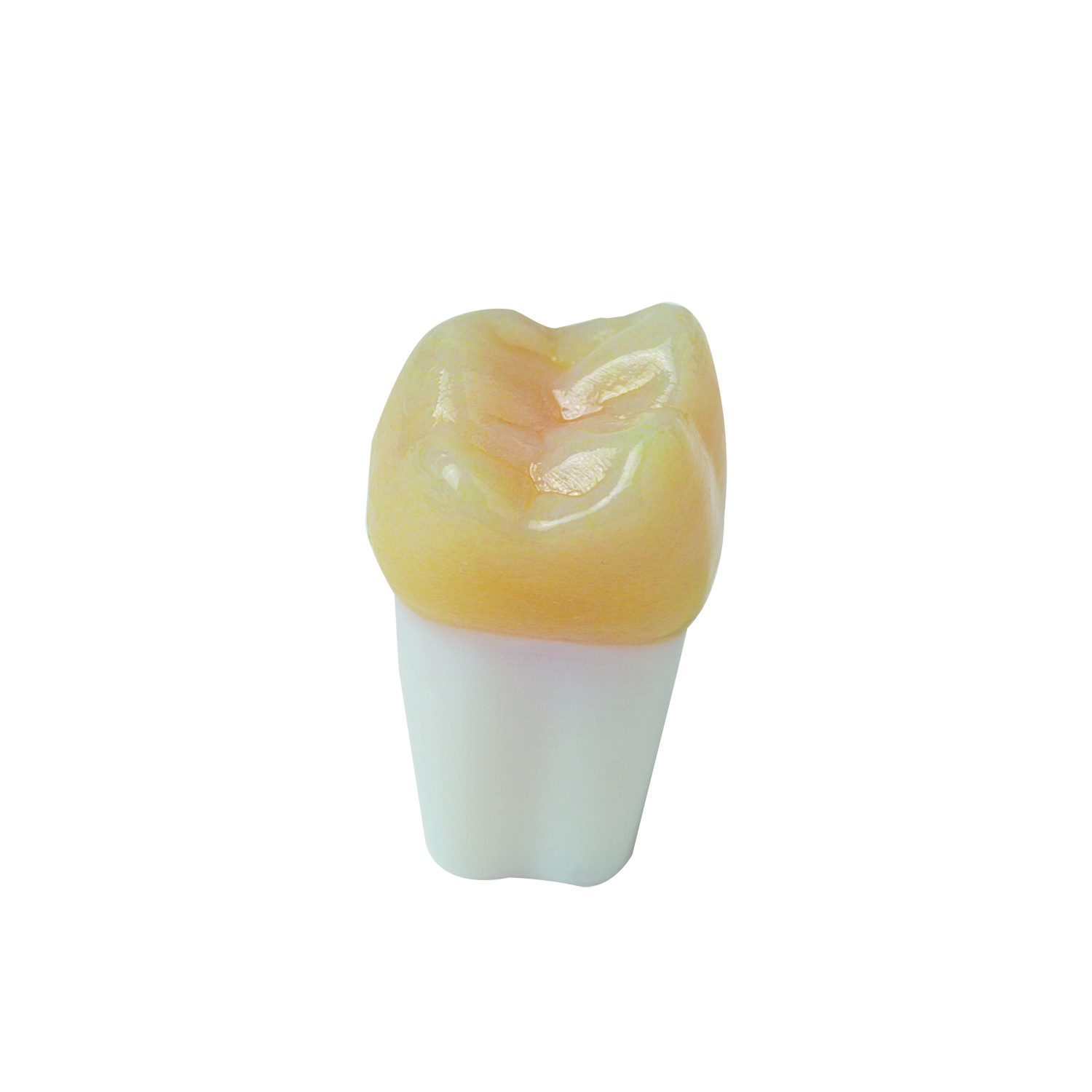 myteeth Übungszahn 26, mit vollanatomischer Krone und Kariesdefekt - 5