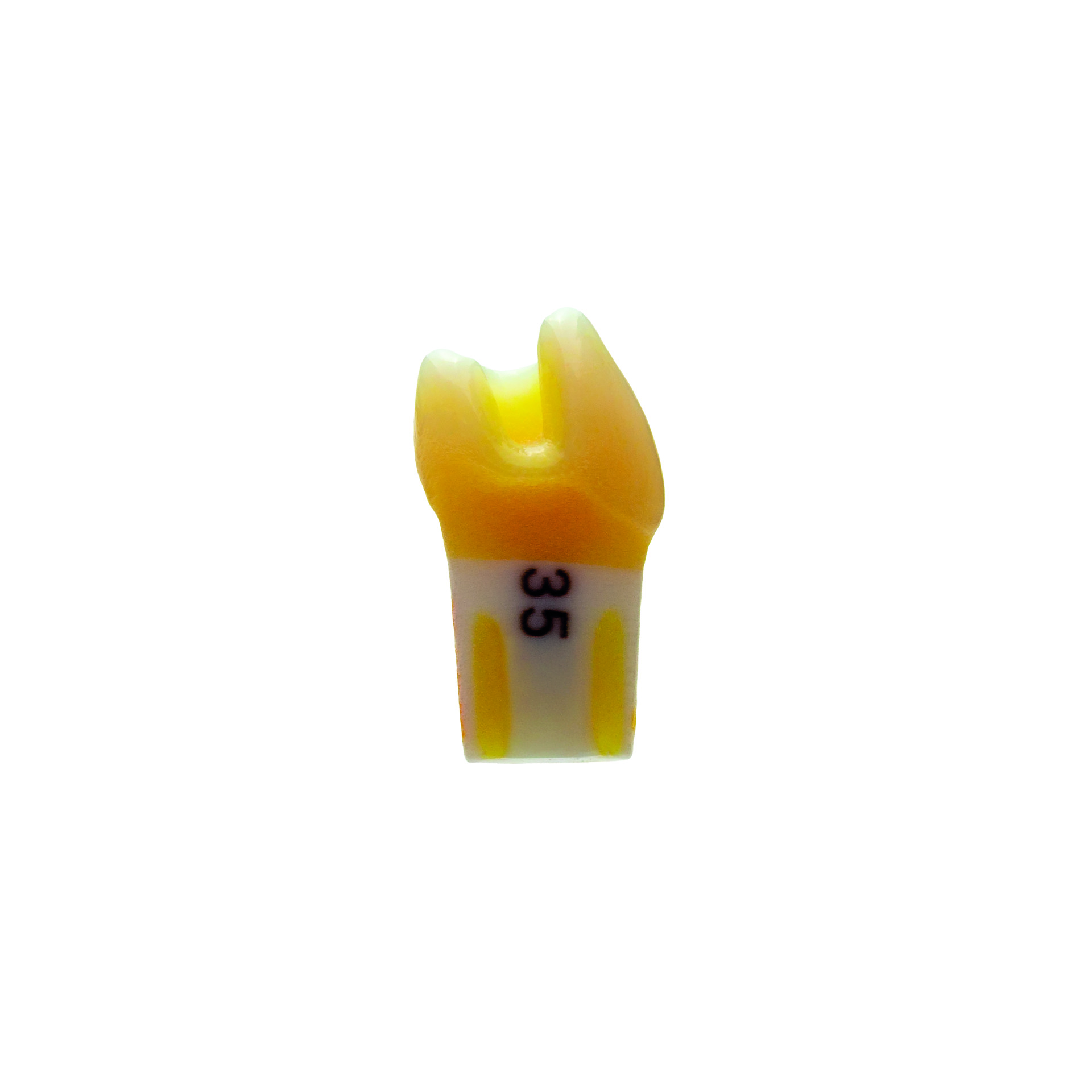 myteeth Übungszahn 35, mit MO Inlay Präparation - 2