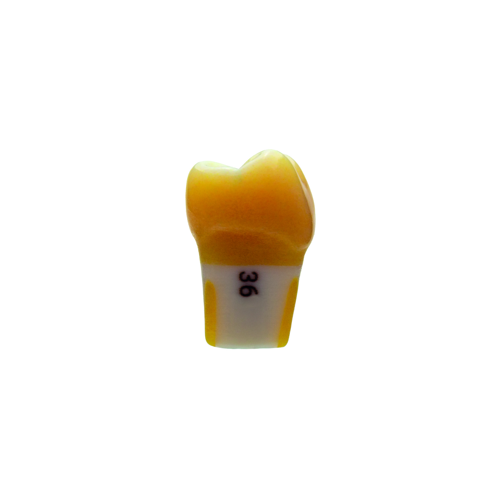 myteeth Übungszahn 36, Fissurenkaries in Zentralfissur - 4